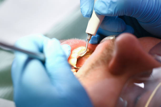 Best Mobile Emergency Dentist in Charlestown, IN